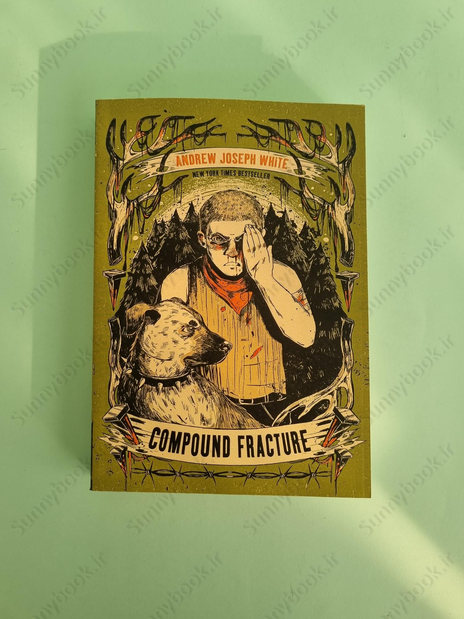 Compound Fracture main 1 2