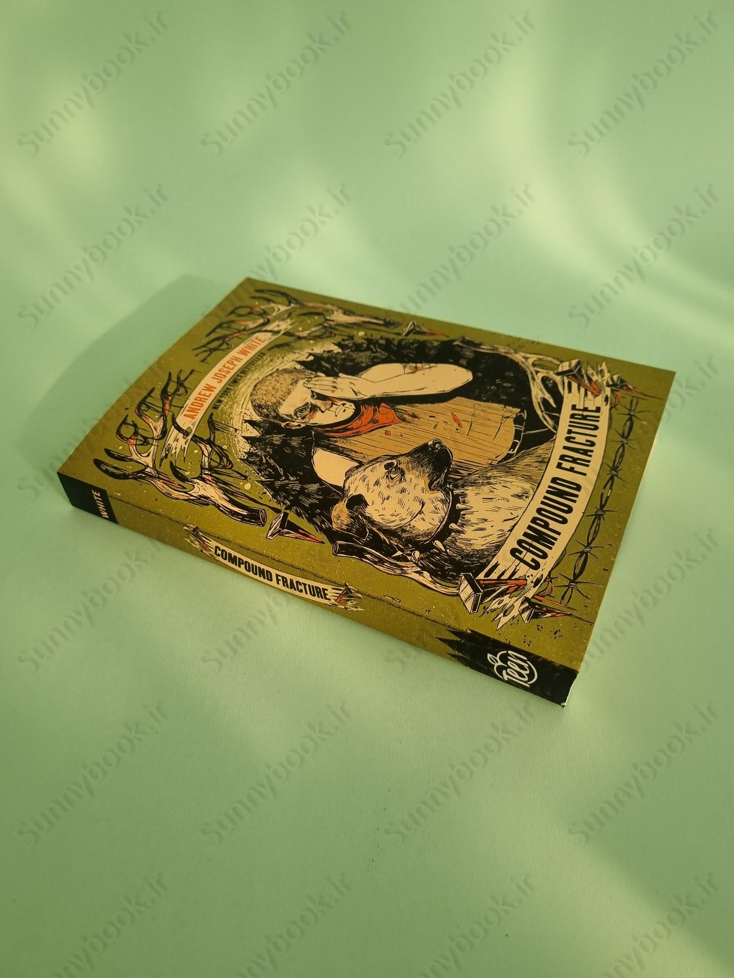 Compound Fracture main 1 3